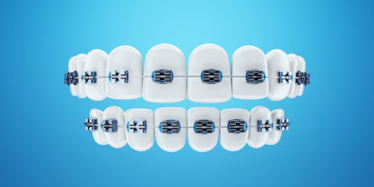 Braces Price Dental Clinic Near Me Icon Dental