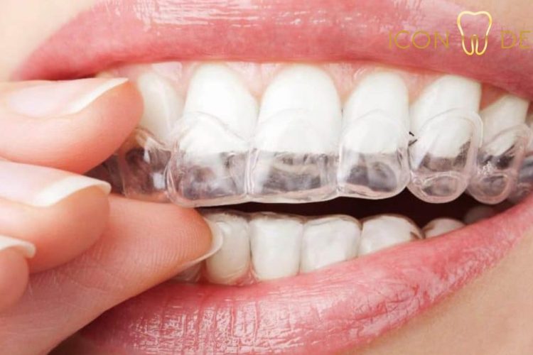 invisalign price malaysia