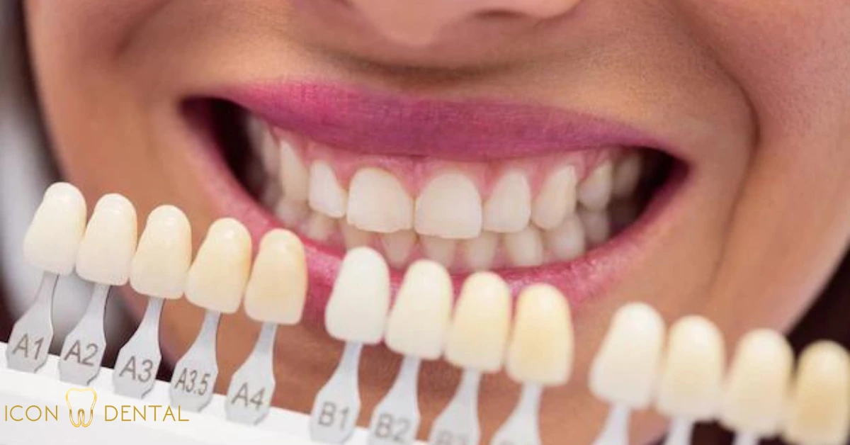Teeth Whitening Malaysia Icon Dental Insights