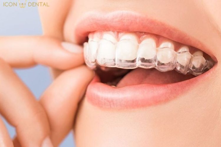 invisalign malaysia