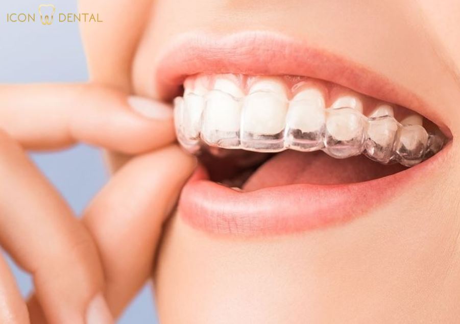 invisalign malaysia