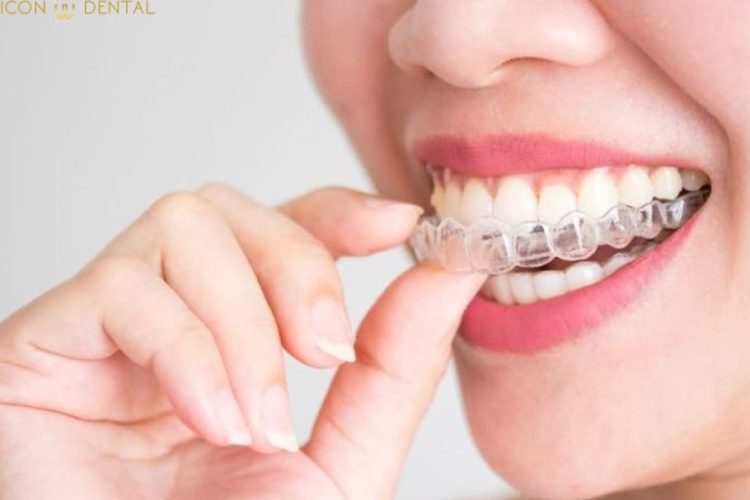 invisalign malaysia