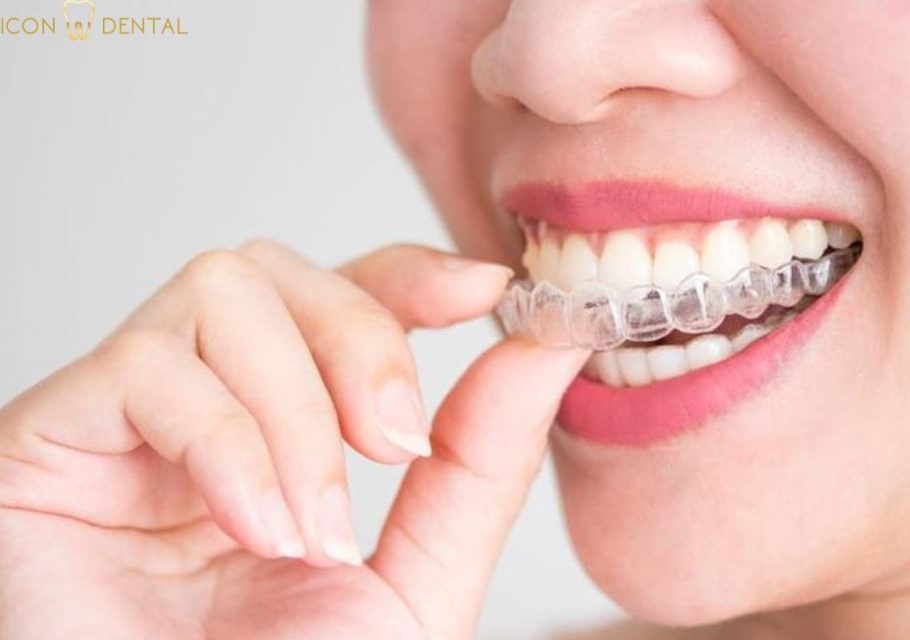 invisalign malaysia